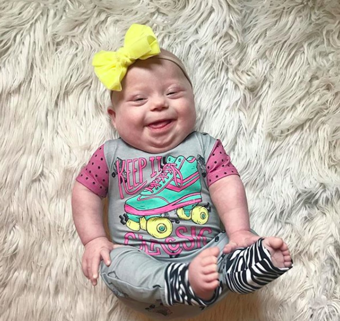 Photos of Babies With Down Syndrome POPSUGAR Family
