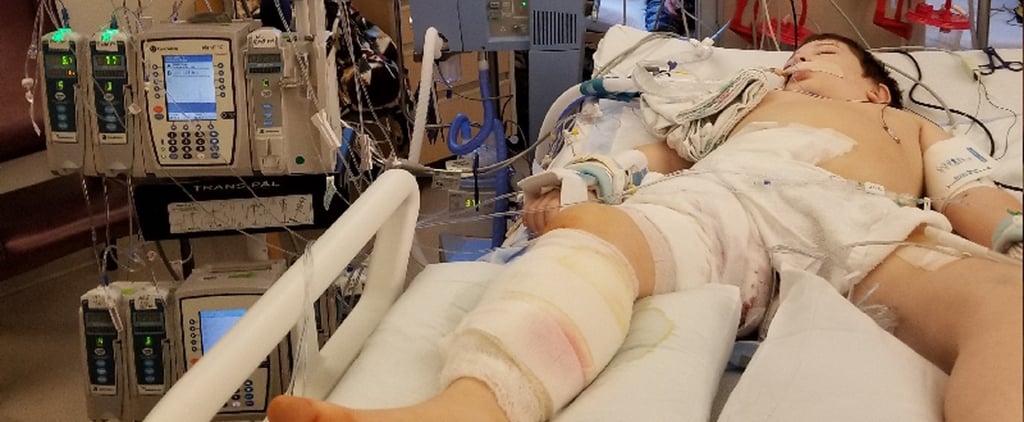8-Year-Old Boy Killed by Flesh-Eating Bacteria