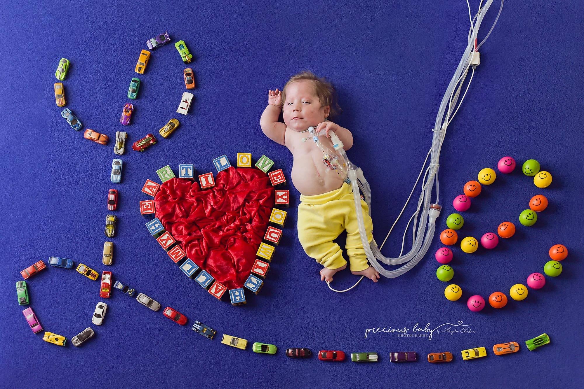 Photos Of Babies With Special Needs On Floor Backdrops Popsugar Family