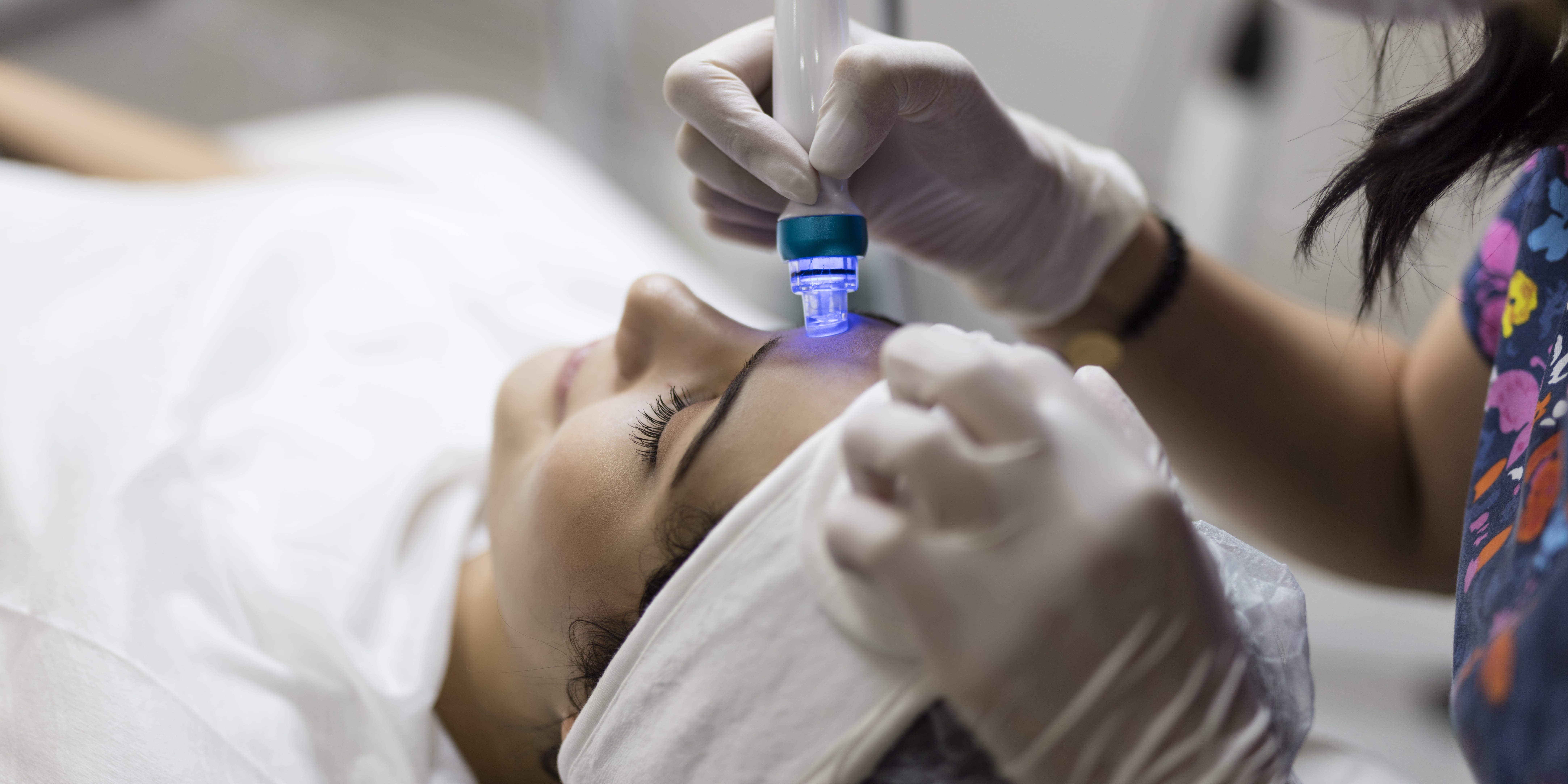 What Is Microdermabrasion? Here Are the Skin-Care Benefits - Vimarsana News