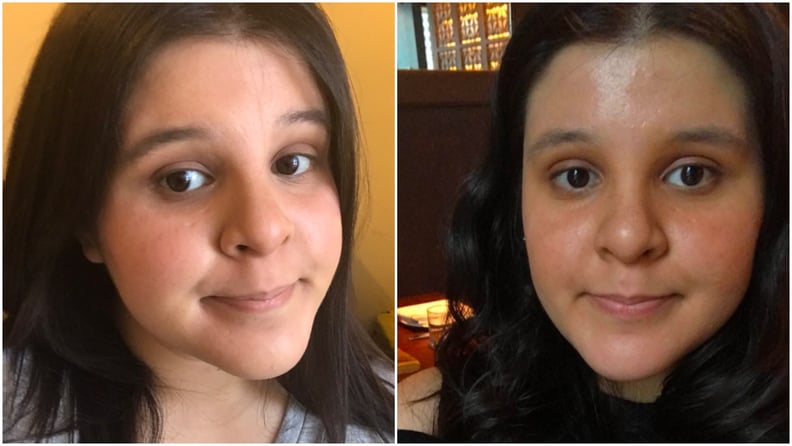 Before and After