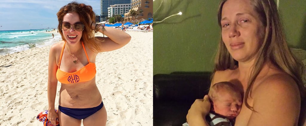 Postpartum Body Stories From 2015