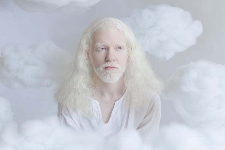 Albinism Photographs Yulia Taits Popsugar Beauty