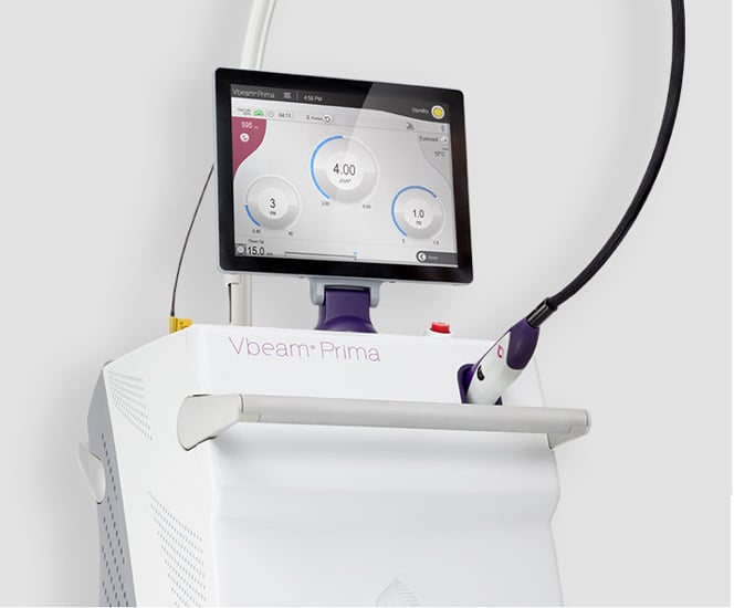 Candela Vbeam Prima Laser