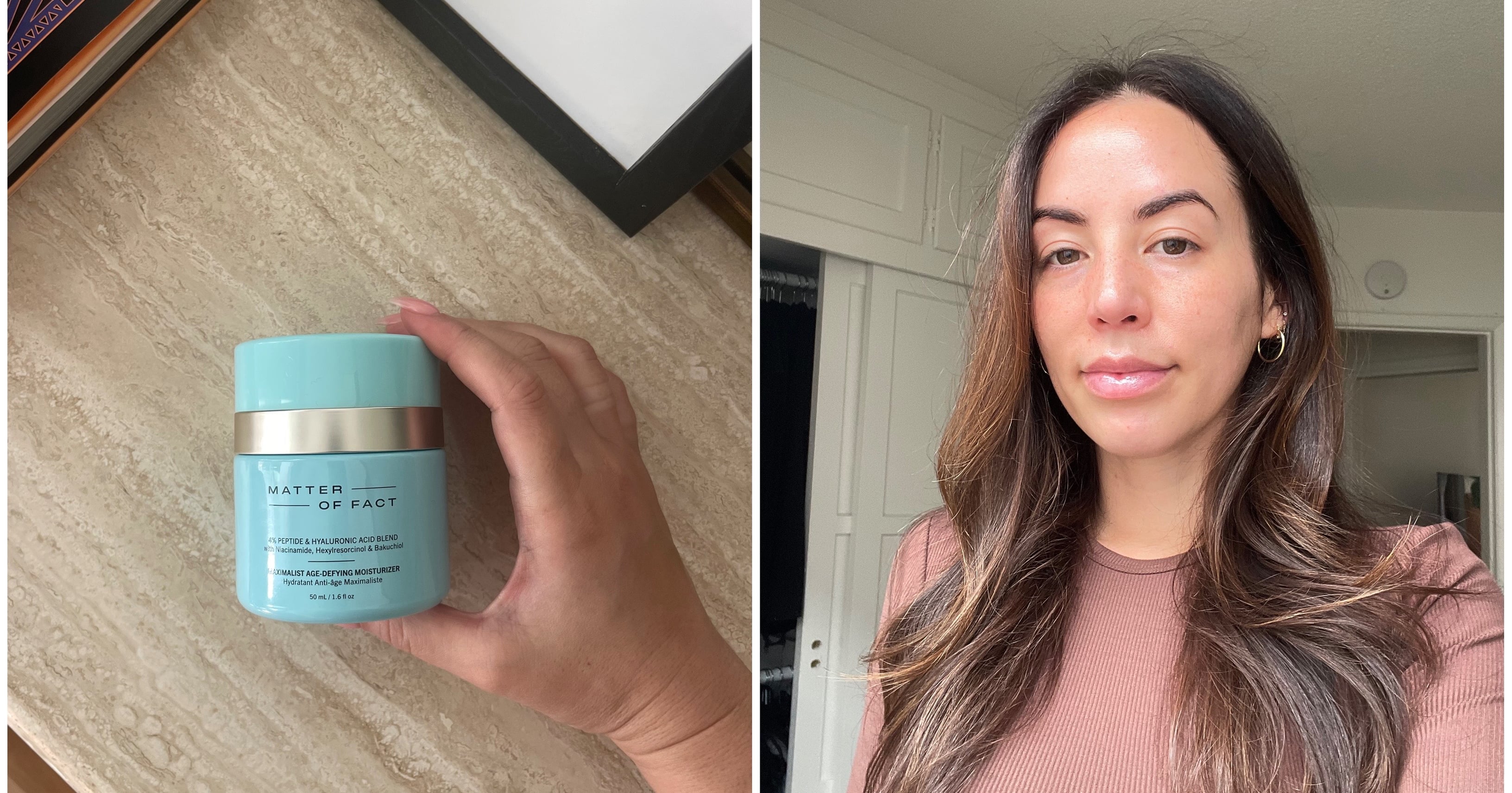 This Is the Best Moisturizer, According to My Picky, Acne-Prone Skin
