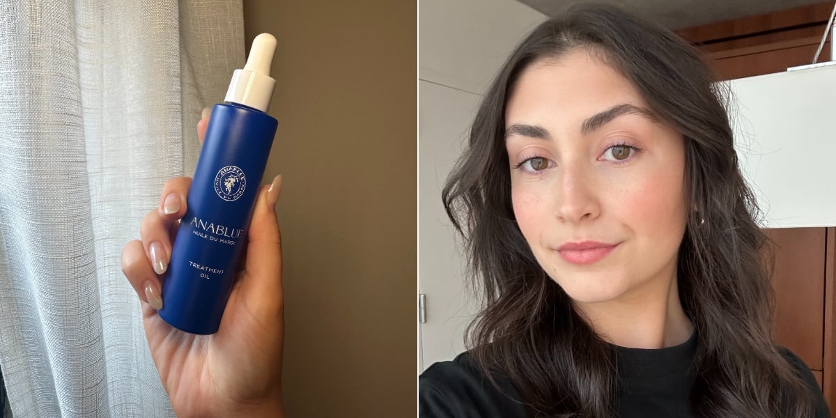 Anablue Treatment Oil Review With Photos - Vimarsana News