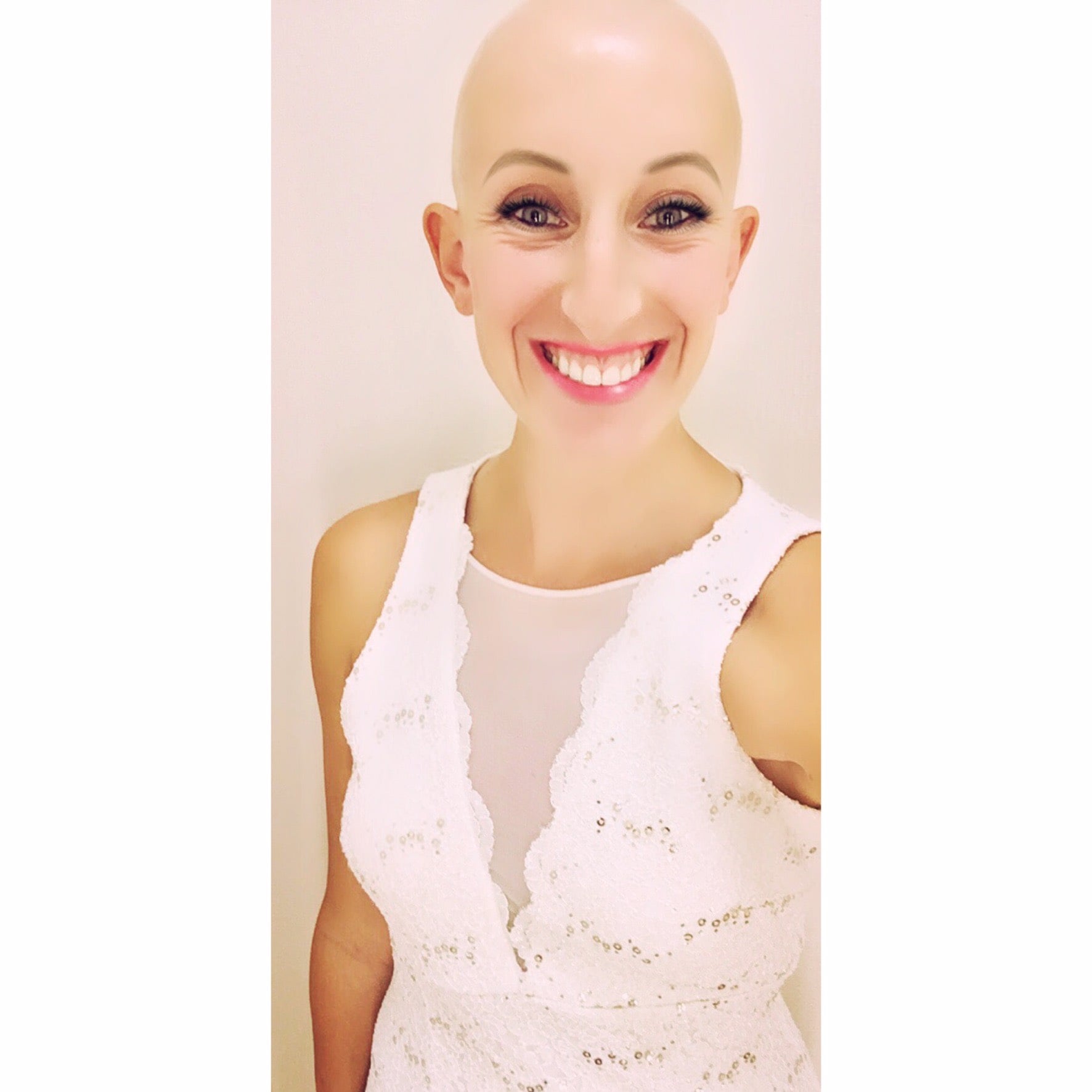 Personal Essay on Running With Alopecia | POPSUGAR Fitness