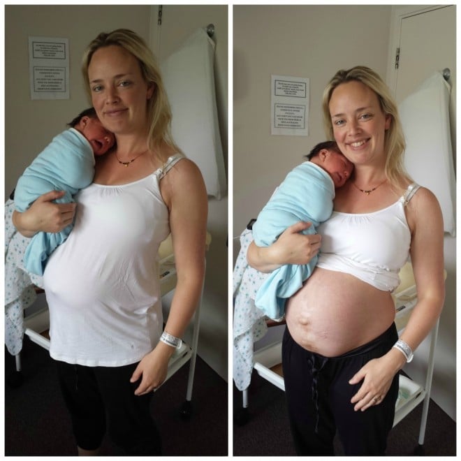 Woman documents her incredible postpartum transformation