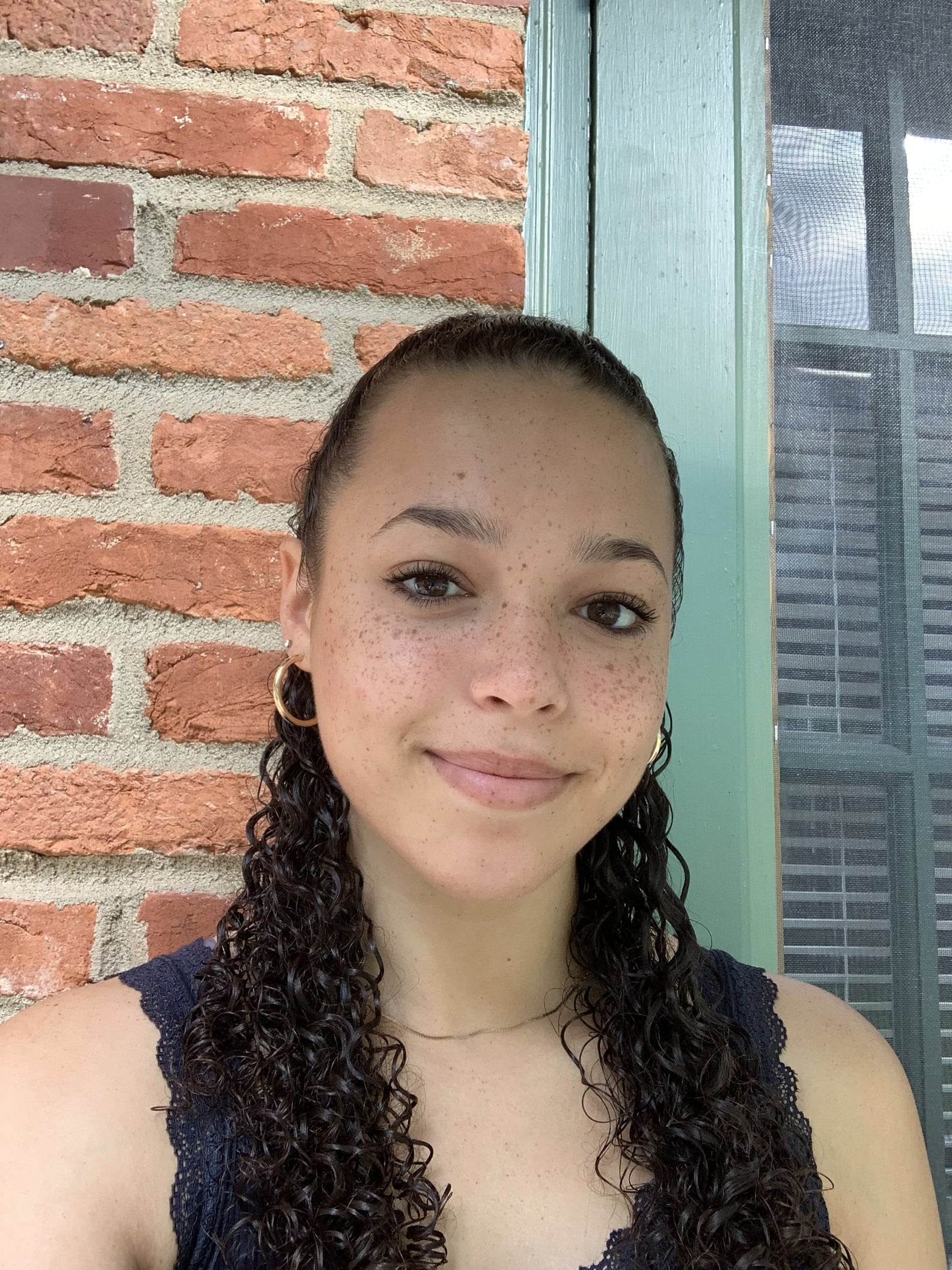 Why I Embrace My Freckles Even When Experiencing Acne | PS Beauty