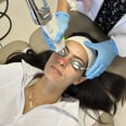I Tried the ClearSilk "Lunch Break" Laser For My Rosacea — See My Results