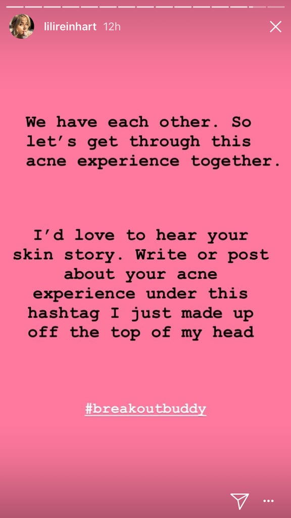 Lili Reinhart Posts About Cystic Acne on Instagram Stories