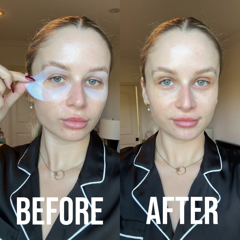 Taylor Before and After Wearing Peace Out Retinol Eye Lift Patches