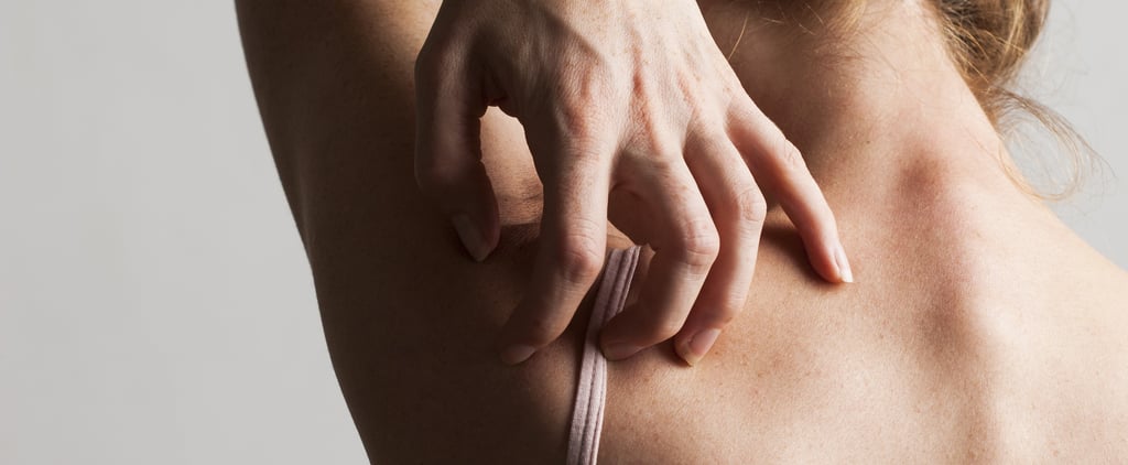 Does Monkeypox Cause Scarring?