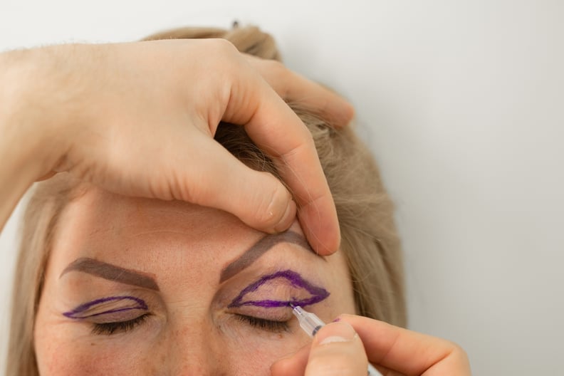 眼睑整形手术前脸上标记特写操作修改眼睛区域面临的医疗诊所。医生做整形美容手术