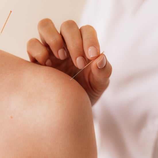 How Does Acupuncture Help Regulate Period?