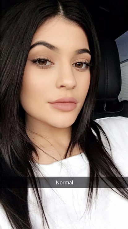 Kylie's "normal" look featuring a relaxed mouth.