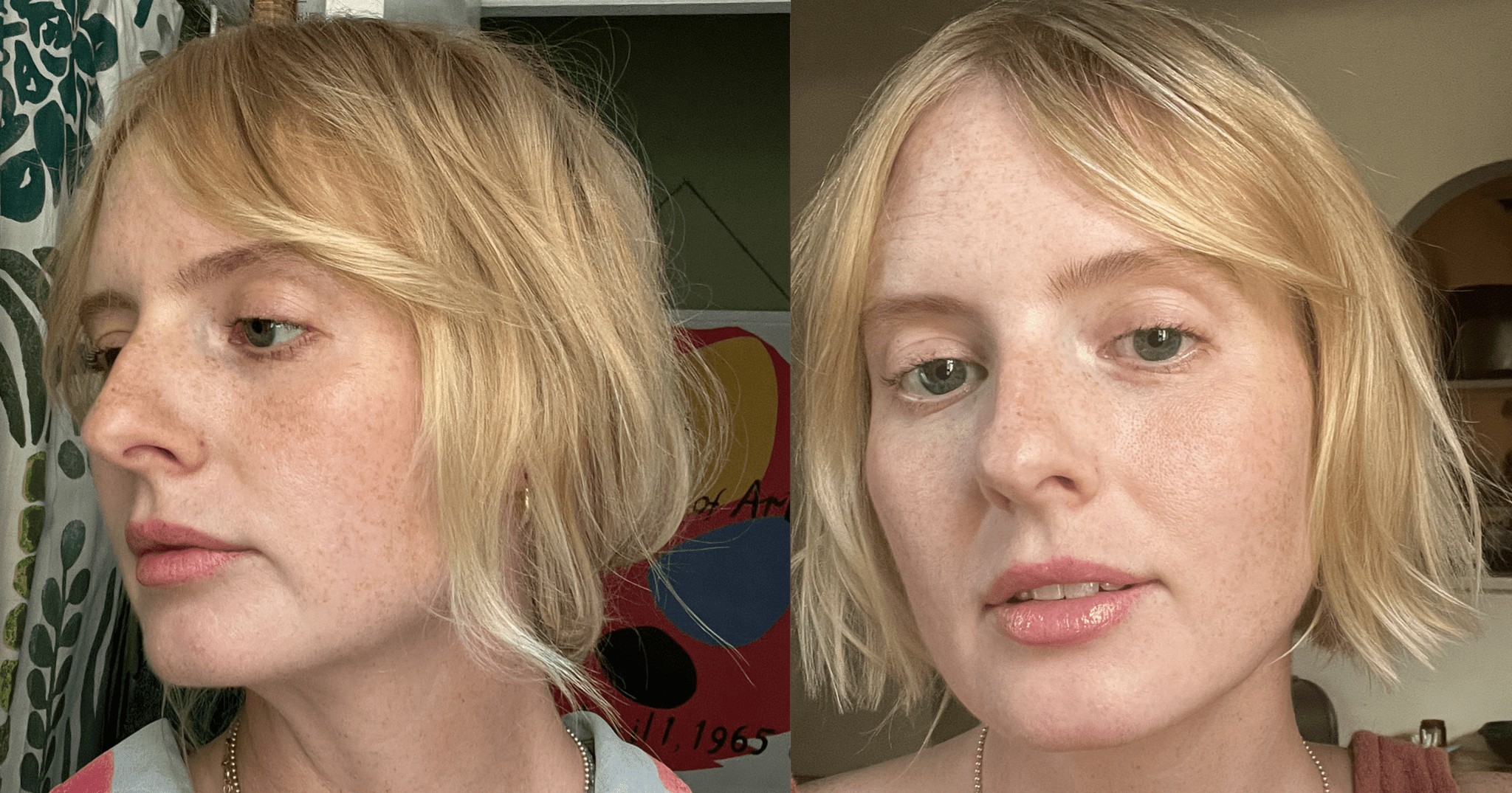 I Tried the Gnarly-Sounding (and Crazy Effective) Ellacor Skin-Tightening Treatment