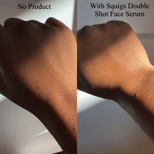 Gif de la diferencia de usar el Squigs Beauty Double Shot Face Serum en mi mano.  El lado izquierdo no tiene producto y el lado derecho tiene Squigs Beauty Double Shot Face Serum.