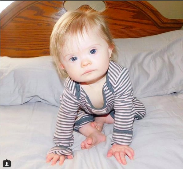 Baby Born With Down Syndrome
