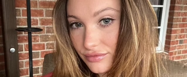 My Hormonal Hair Loss & Regrowth Journey From an IUD
