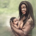 The Incredible Story Behind 1 Burn Survivor's Breastfeeding Journey