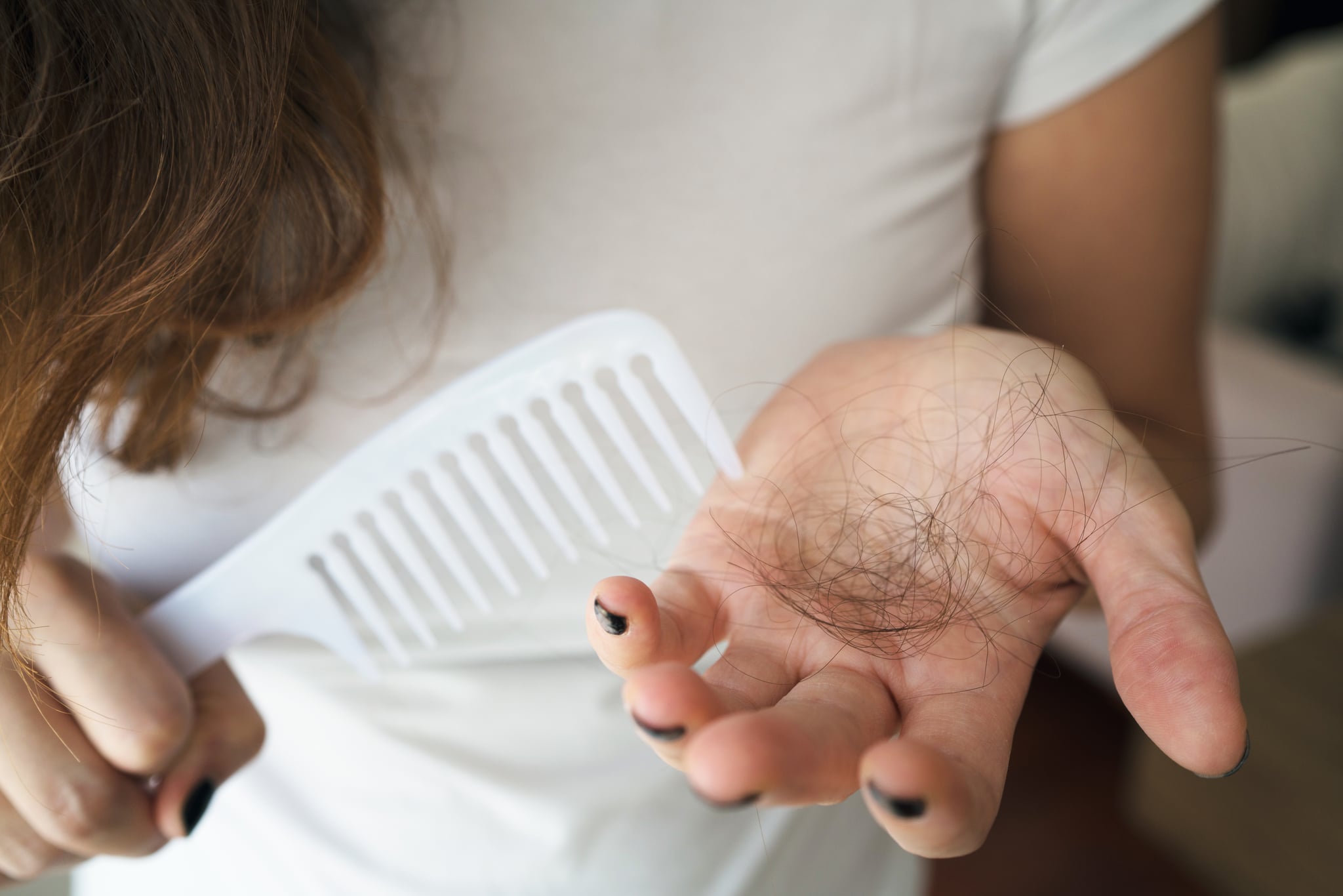 Woman losing hair on hairbrush in hand