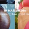 You've Never Seen Stretch Marks in the Media Like This