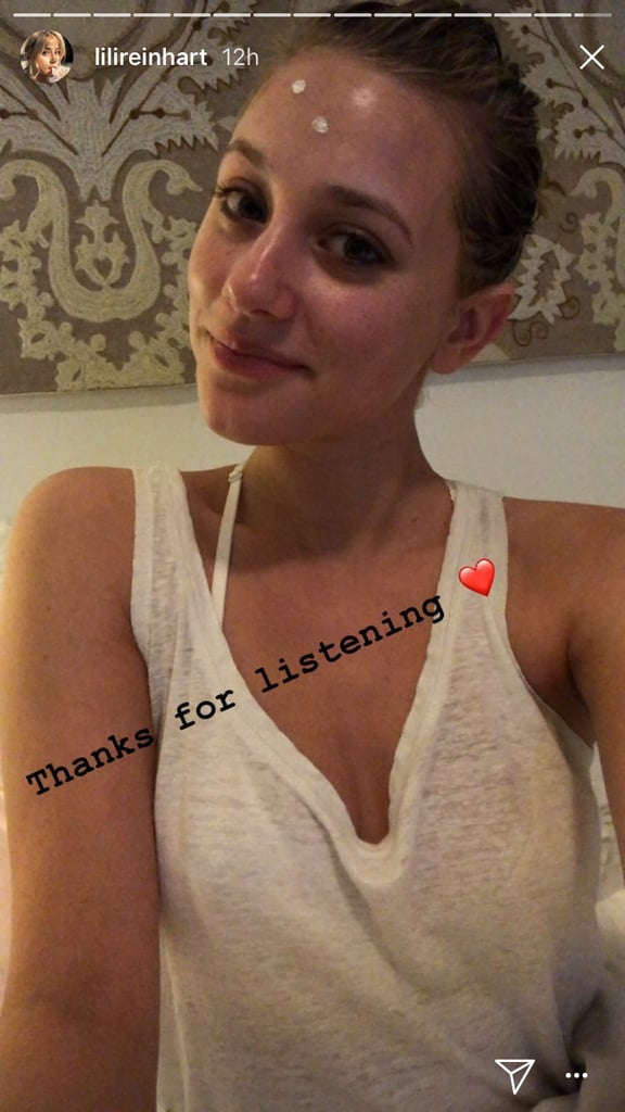 Lili Reinhart Posts About Cystic Acne on Instagram Stories