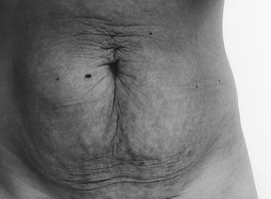 Mom Explains Why She's Proud of Her Body After Giving Birth