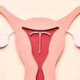 Is IUD Pain Finally Being Taken Seriously?