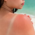How to Heal a Sunburn ASAP, According to Skin-Care Experts