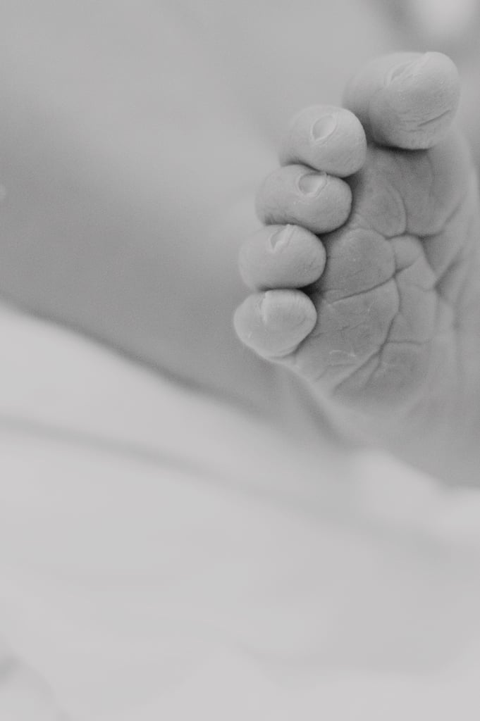C-Section Birth Photos C-Section Birth Photos