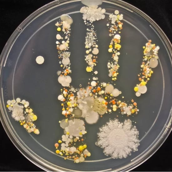 Photo of Bacteria on 8-Year-Old Boy's Hand