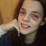This Makeup Artist Flaunting Eczema