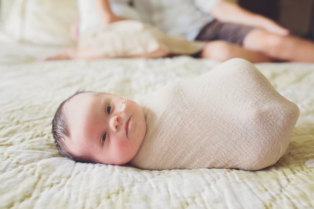 Newborn With Inoperable Tumor in Family Photos