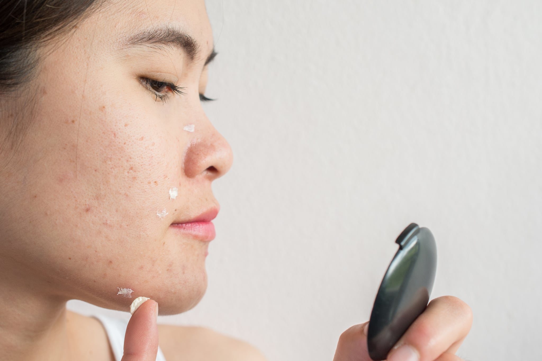 To heal a overnight how popped pimple How to