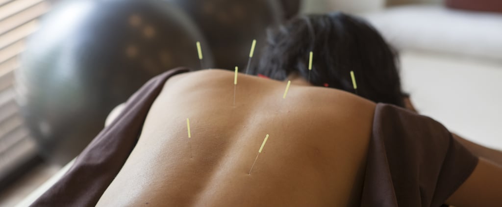 My Fear of Needles Didn't Stop Me From Getting Acupuncture, and Here's Why I'll Be Going Back