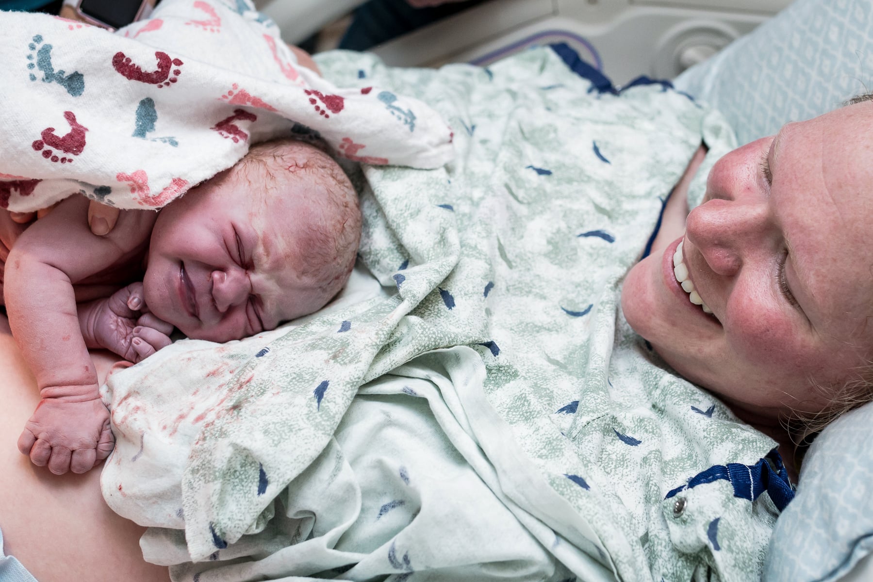 Baby Born With Umbilical Cord Wrapped Around Her Stomach ...