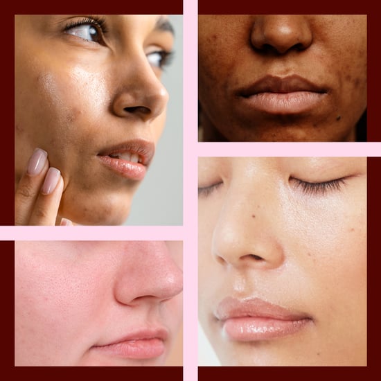 Skin Type Quiz: What Is Your Skin Type?