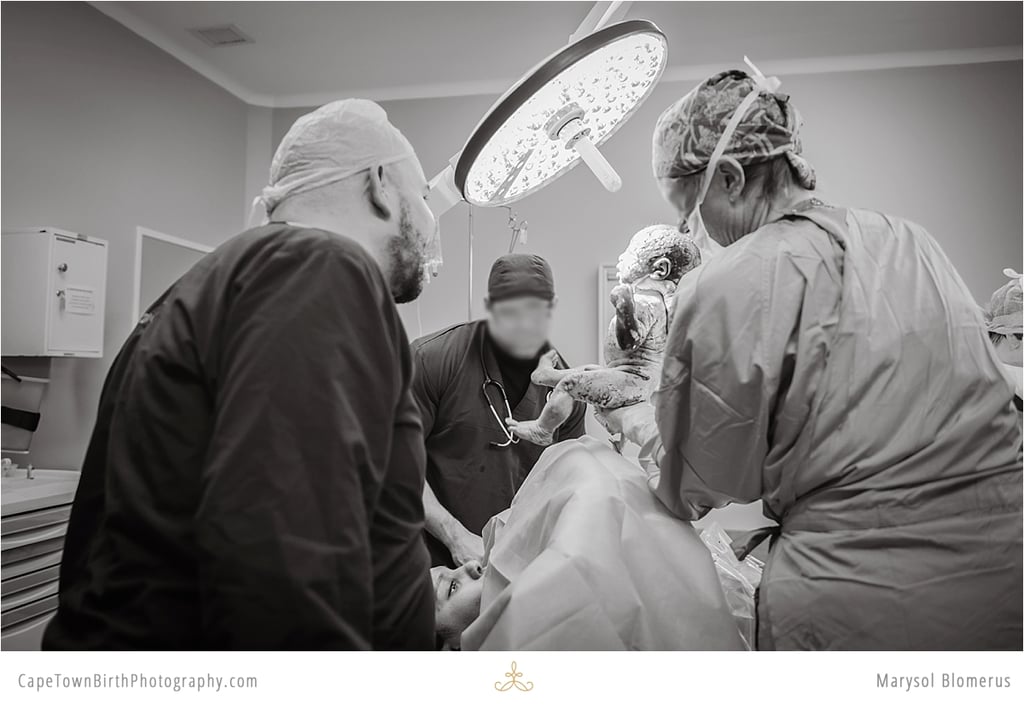 Photos of C-Sections
