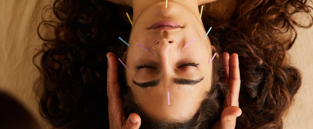 Cosmetic Acupuncture 101: Everything You Need to Know