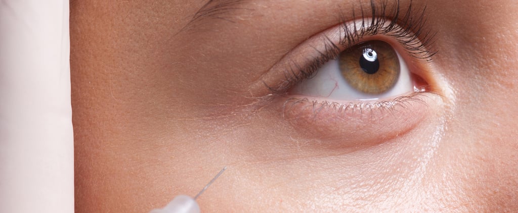 What Is Restylane Eyelight Undereye Filler?