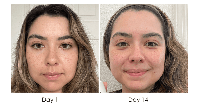 Before-and-After Photos - Jones Road Multivitamin Serum