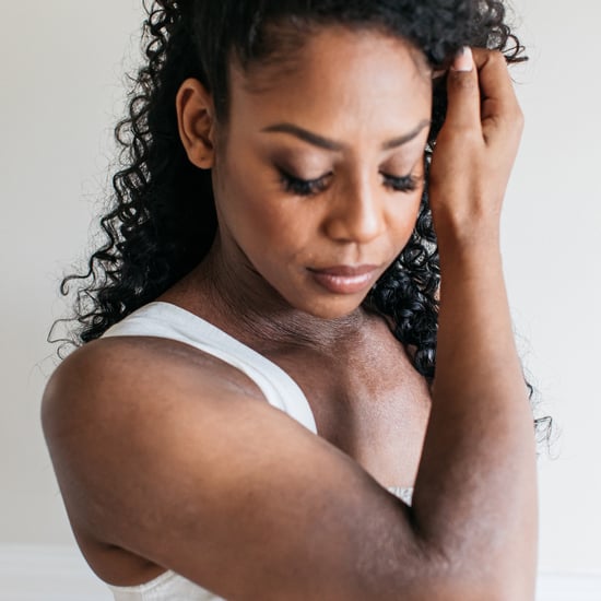 A Dermatologist Rates 7 Viral TikTok Eczema Hacks