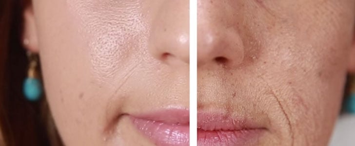 What Smoking Does to Your Face
