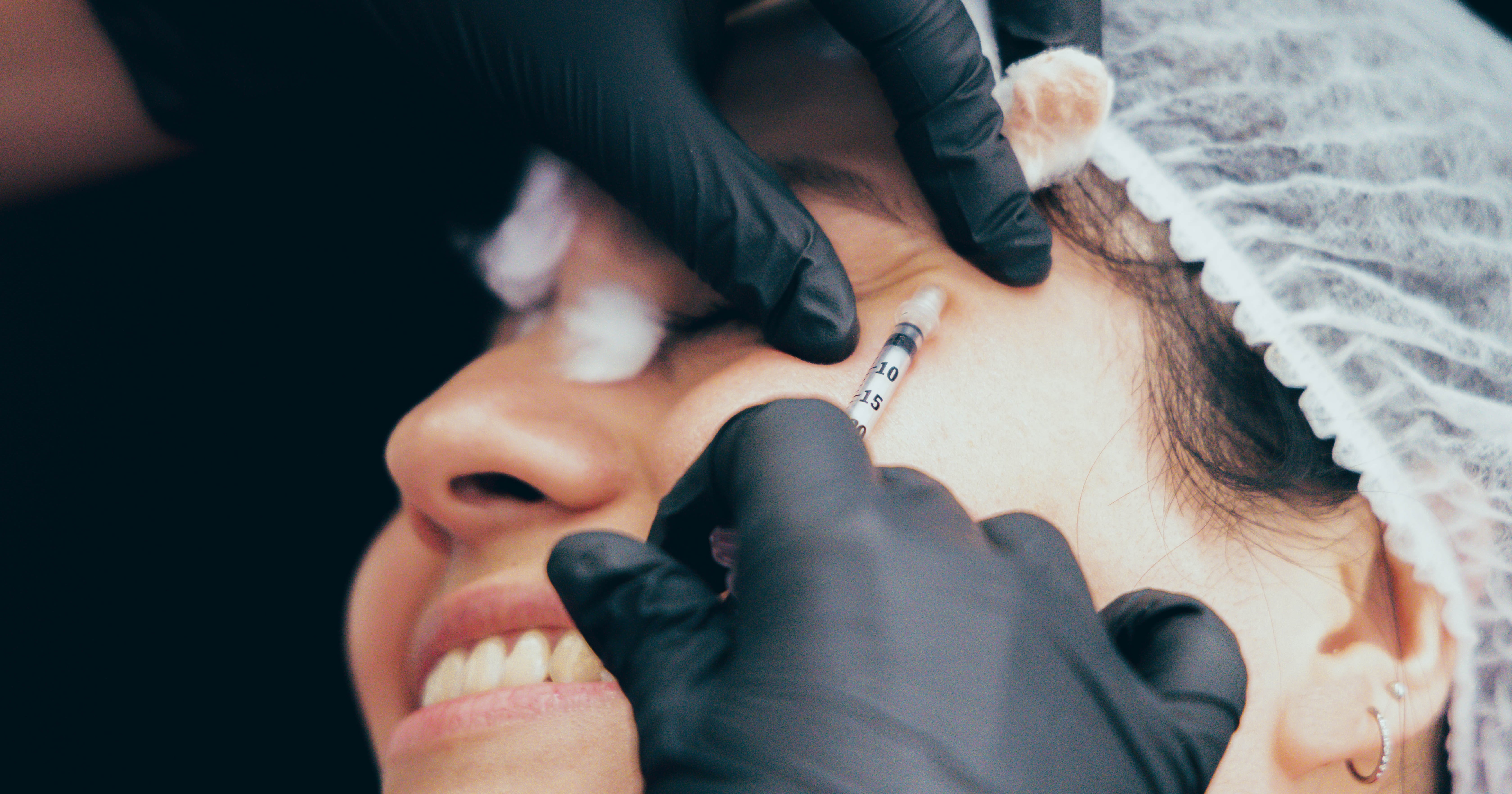 The 411 on "Jelly Roll" Botox - A Treatment For Puffy Undereyes