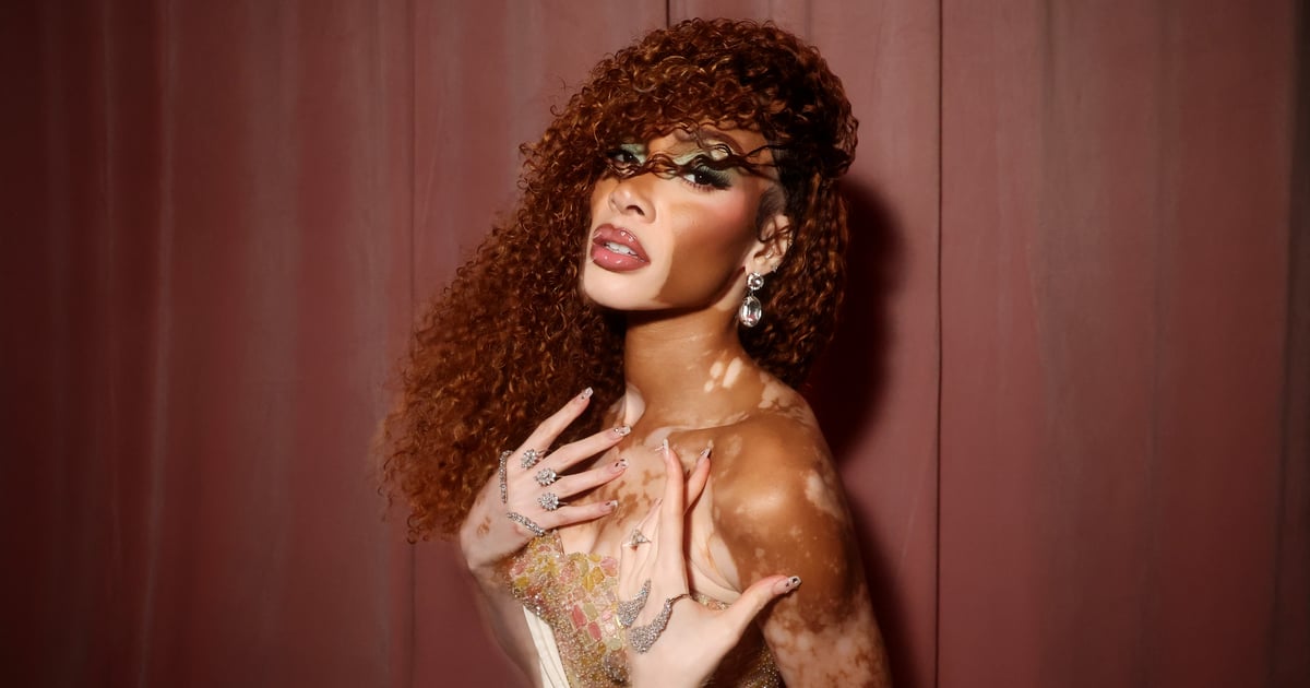 Winnie Harlow Has Some (Inner) Beauty Advice