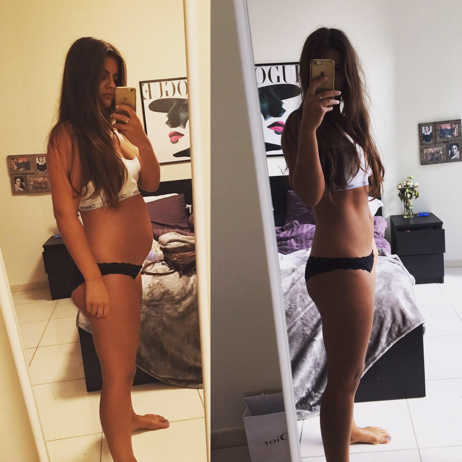 Food Intolerance Makes Dubai Woman Look 6 Months Pregnant