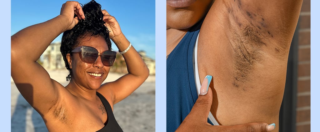 How I Learned to Accept My Hidradenitis Suppurativa