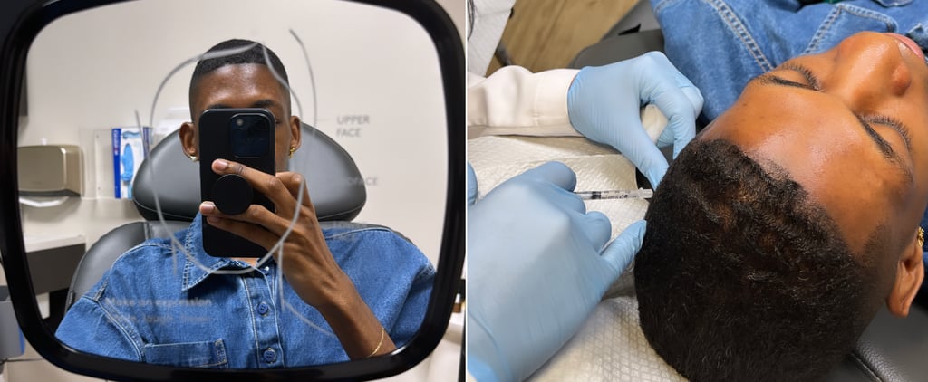 I Tried Botox For My Edges: See Photos